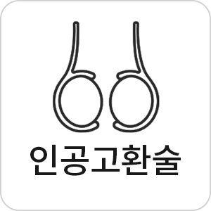 �ΰ���ȯ��